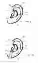 Fig. 03 - External ear insert for hearing comprehension enhancement