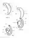 Fig. 04 - External ear insert for hearing comprehension enhancement