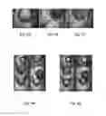Fig. 04 - Method and system for recognizing and assessing surgical procedures from video
