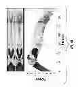 Fig. 40 - Inversion-based workflow for processing nuclear density images in high-angle and horizontal wells