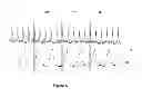 Fig. 06 - Heart imaging method