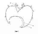 Fig. 07 - Heart imaging method