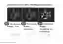 Fig. 08 - Method and system for analyzing biological specimens by spectral imaging