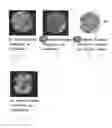 Fig. 09 - Method and system for analyzing biological specimens by spectral imaging