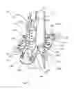 Fig. 04 - Alignment tool for aligning subsea elements in a piggybacked arrangement
