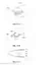 Fig. 11 - AEROGENERATOR BLADE TIP SEGMENT AND METHOD OF ASSEMBLY
