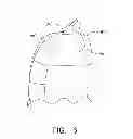 Fig. 07 - Dust mitigation for turbine blade tip turns