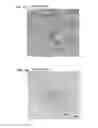 Fig. 06 - Isolated discogenic cells, methods of using, and methods of preparing same from mammalian tissue