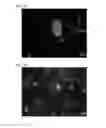 Fig. 07 - Isolated discogenic cells, methods of using, and methods of preparing same from mammalian tissue