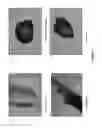 Fig. 03 - Compositions for the mobilization, homing, expansion and differentiation of stem cells and methods of using the same