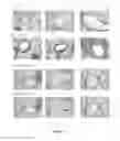 Fig. 07 - METHOD FOR TREATMENT OR PREVENTION OF ALLERGIC DISEASES