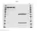 Fig. 03 - STABLE IGG4 BASED BINDING AGENT FORMULATIONS