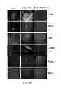 Fig. 10 - Inhibitors of metastasis, methods of generating such inhibitors and their therapeutic applications