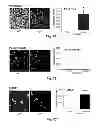 Fig. 11 - Inhibitors of metastasis, methods of generating such inhibitors and their therapeutic applications