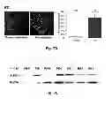 Fig. 12 - Inhibitors of metastasis, methods of generating such inhibitors and their therapeutic applications