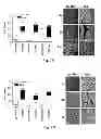 Fig. 13 - Inhibitors of metastasis, methods of generating such inhibitors and their therapeutic applications