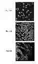 Fig. 20 - Inhibitors of metastasis, methods of generating such inhibitors and their therapeutic applications