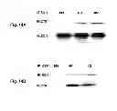 Fig. 22 - Inhibitors of metastasis, methods of generating such inhibitors and their therapeutic applications