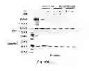 Fig. 30 - Inhibitors of metastasis, methods of generating such inhibitors and their therapeutic applications