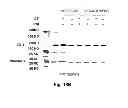 Fig. 31 - Inhibitors of metastasis, methods of generating such inhibitors and their therapeutic applications