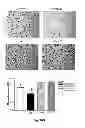 Fig. 34 - Inhibitors of metastasis, methods of generating such inhibitors and their therapeutic applications
