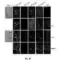 Fig. 35 - Inhibitors of metastasis, methods of generating such inhibitors and their therapeutic applications