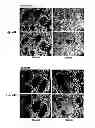 Fig. 40 - Inhibitors of metastasis, methods of generating such inhibitors and their therapeutic applications