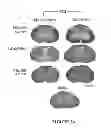 Fig. 04 - Methods of modulating inflammasome activity to treat inflammatory conditions