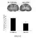 Fig. 06 - Methods of modulating inflammasome activity to treat inflammatory conditions