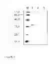 Fig. 08 - Hypoallergenic chimeric proteins belonging to the lipid transfer family of for use in the treatment of allergies