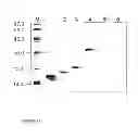 Fig. 10 - Hypoallergenic chimeric proteins belonging to the lipid transfer family of for use in the treatment of allergies