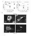 Fig. 06 - Modified gram-negative bacteria for use as vaccines