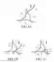 Fig. 02 - High density fibrous polymers suitable for implant