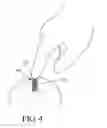 Fig. 05 - High density fibrous polymers suitable for implant