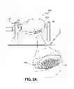 Fig. 03 - Lipid therapy