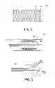 Fig. 07 - Lipid therapy