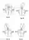 Fig. 05 - MODEL