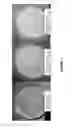 Fig. 07 - Glucose and insulin sensors and methods of use thereof