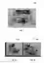Fig. 02 - Magnetic separation of cells