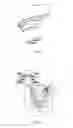 Fig. 02 - TENSIONER