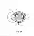 Fig. 07 - TENSIONER
