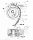 Fig. 30 - Tensioner with increased damping