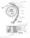 Fig. 31 - Tensioner with increased damping
