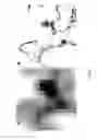 Fig. 17 - Optical microscopy with phototransformable optical labels