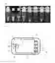 Fig. 07 - Sample processing method and sample processing cartridge