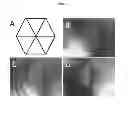 Fig. 07 - Engineered liver tissues, arrays thereof, and methods of making the same