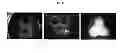 Fig. 12 - Engineered liver tissues, arrays thereof, and methods of making the same