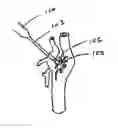 Fig. 01 - METHODS AND DEVICES FOR AFFECTING NERVE FUNCTION