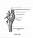 Fig. 03 - METHODS AND DEVICES FOR AFFECTING NERVE FUNCTION