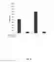 Fig. 41 - USE OF TRANSLATIONAL PROFILING TO IDENTIFY TARGET MOLECULES FOR THERAPEUTIC TREATMENT